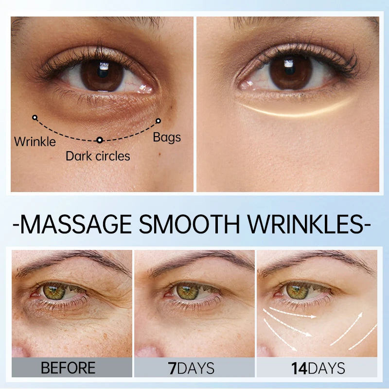 Dark Circles Remover Eye Bags Hyaluronic Acid Anti Wrinkle Skin Care.